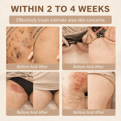 Ndken® Biotin 10-in-1 Skin Restoration Cream