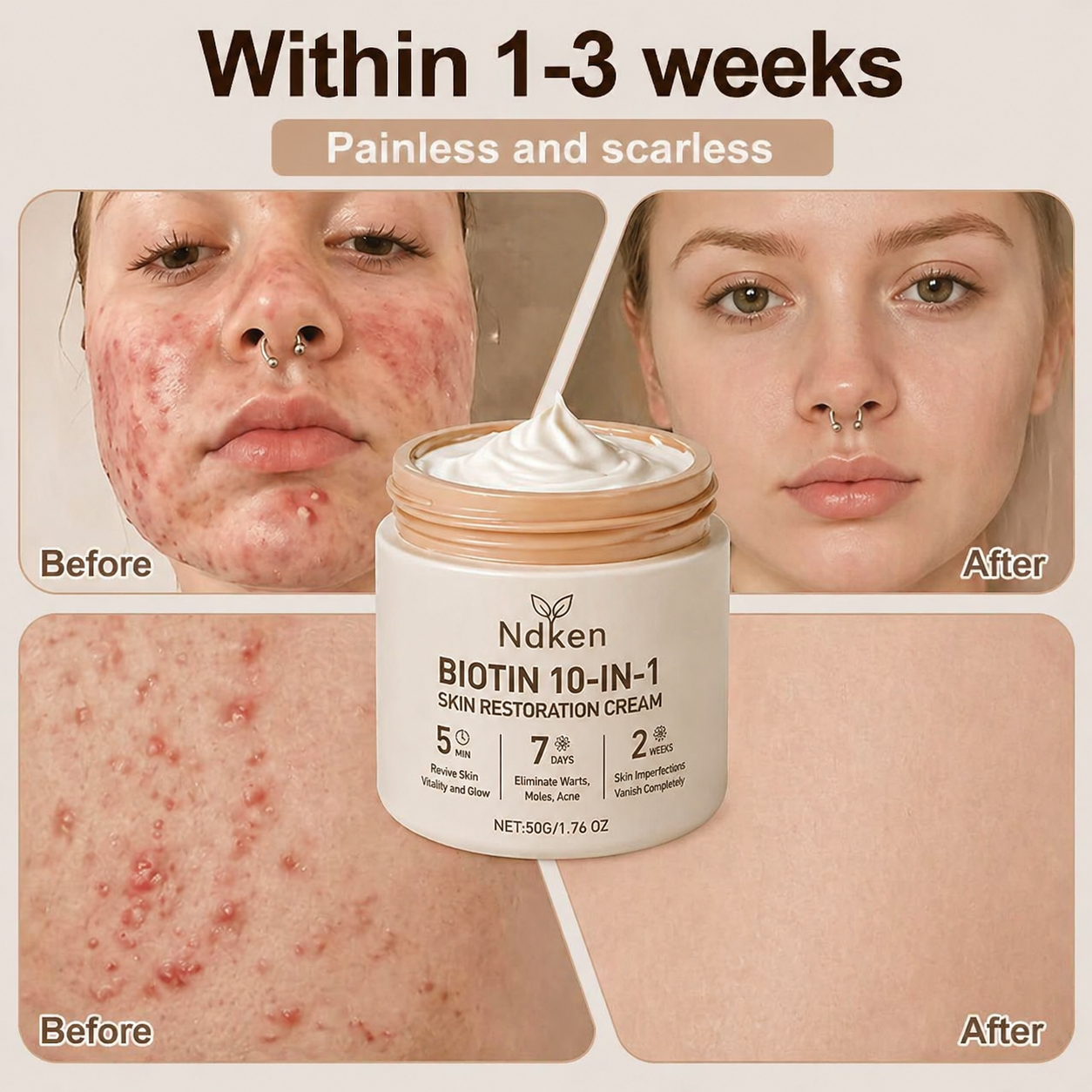 Ndken® Biotin 10-in-1 Skin Restoration Cream