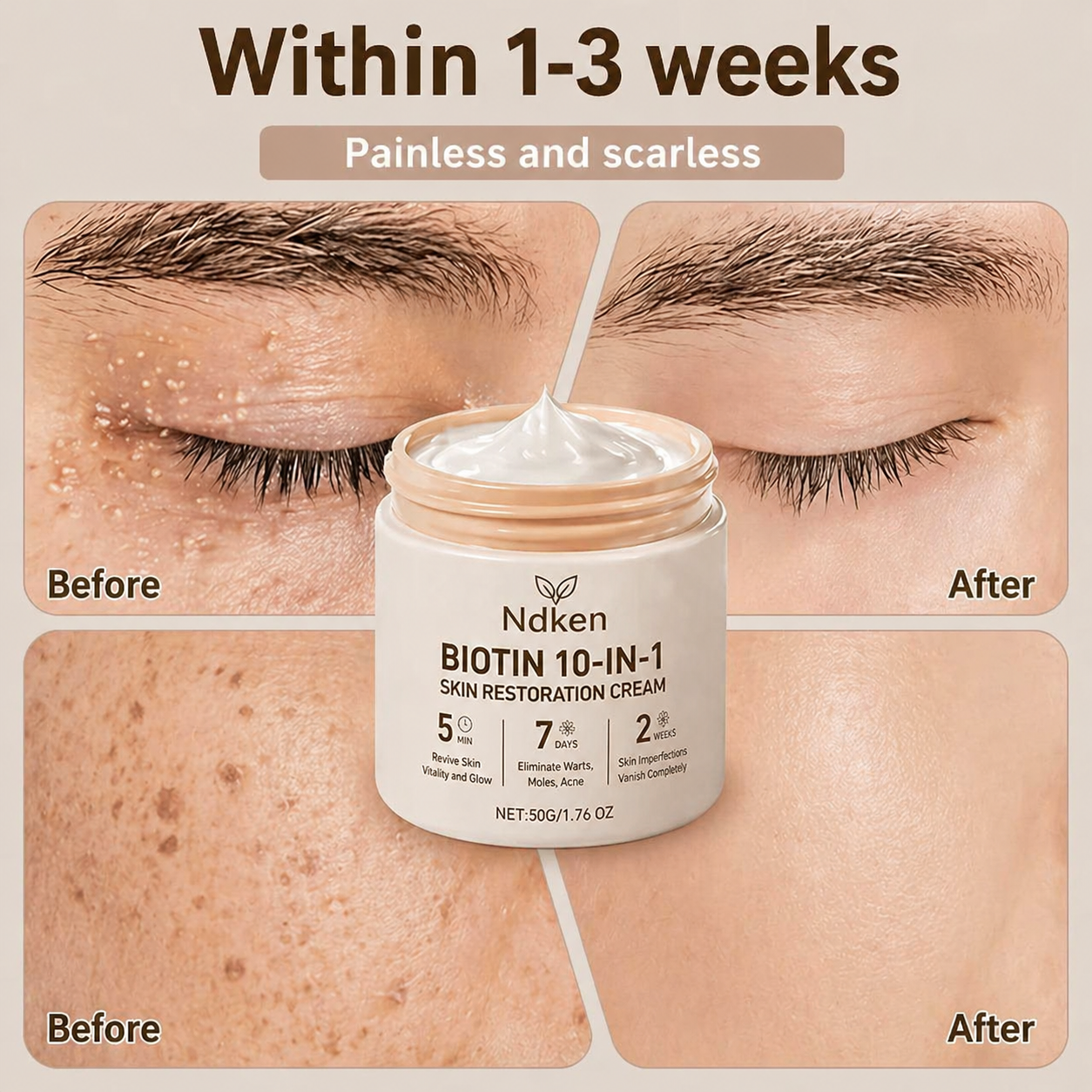 Ndken® Biotin 10-in-1 Skin Restoration Cream