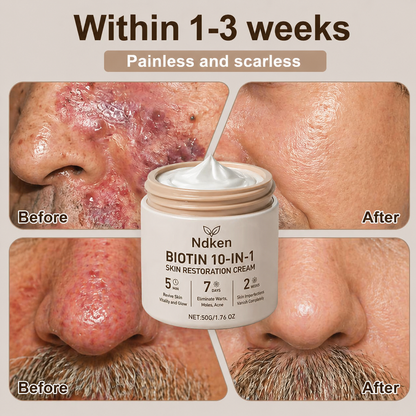 Ndken® Biotin 10-in-1 Skin Restoration Cream