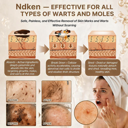 Ndken® Biotin 10-in-1 Skin Restoration Cream