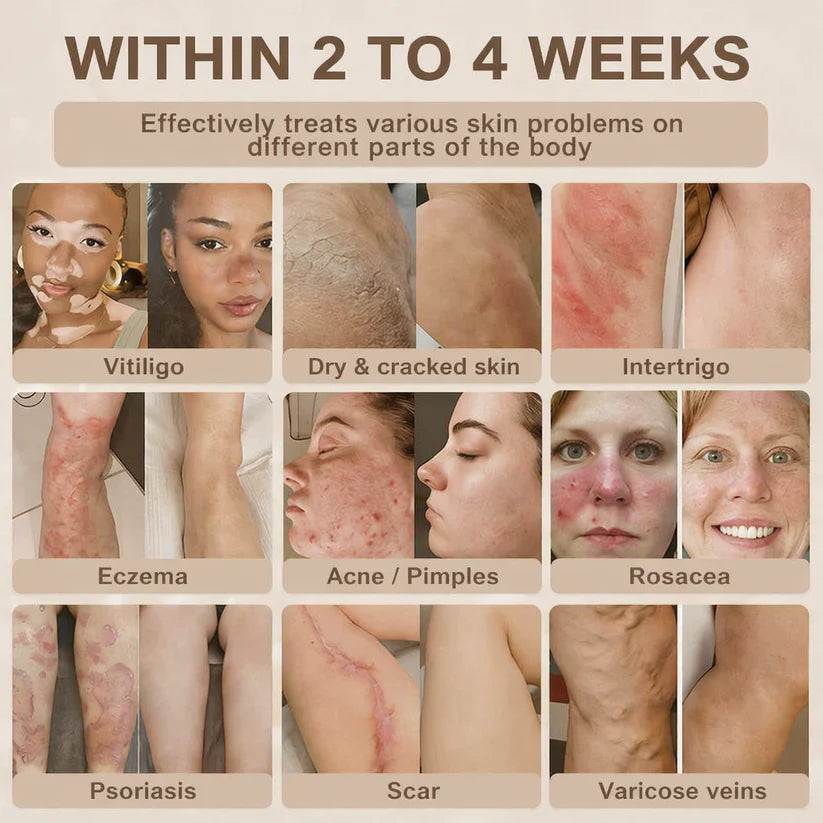 Ndken® Biotin 10-in-1 Skin Restoration Cream