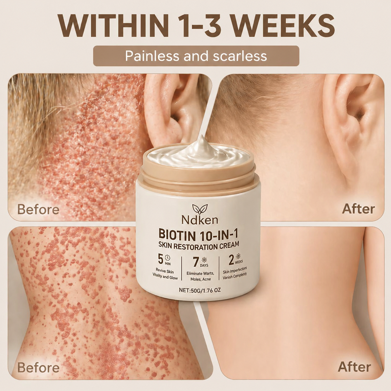 Ndken® Biotin 10-in-1 Skin Restoration Cream