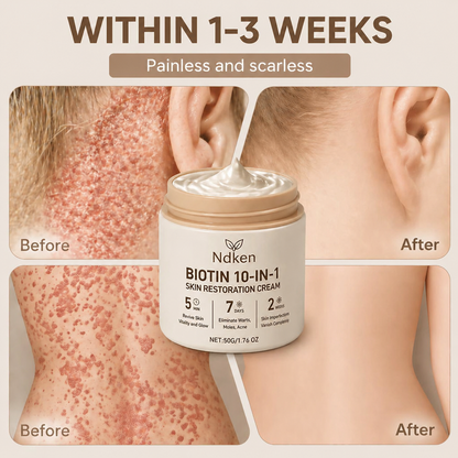 Ndken® Biotin 10-in-1 Skin Restoration Cream