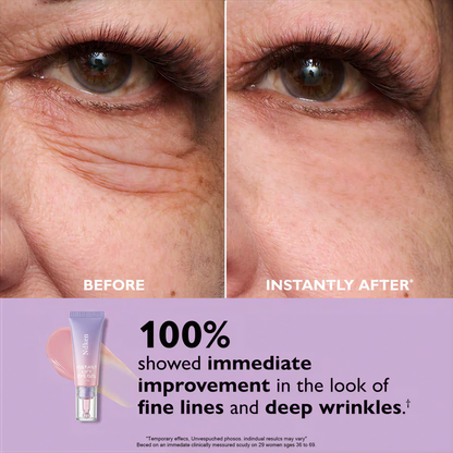 🚨 LIMITED TIME ✨ Instant Eye Bag Eraser 🧴 Blur Wrinkles, Lift & Firm in Seconds 💫