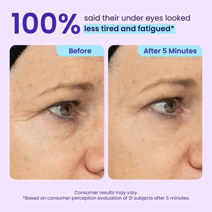 🚨 LIMITED TIME ✨ Instant Eye Bag Eraser 🧴 Blur Wrinkles, Lift & Firm in Seconds 💫
