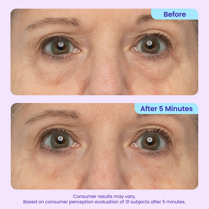 🚨 LIMITED TIME ✨ Instant Eye Bag Eraser 🧴 Blur Wrinkles, Lift & Firm in Seconds 💫
