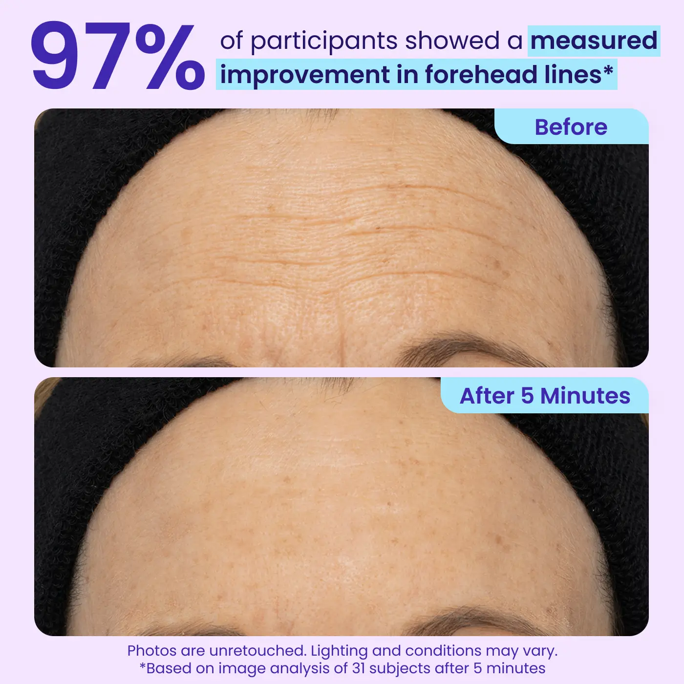 🚨 LIMITED TIME ✨ Instant Eye Bag Eraser 🧴 Blur Wrinkles, Lift & Firm in Seconds 💫