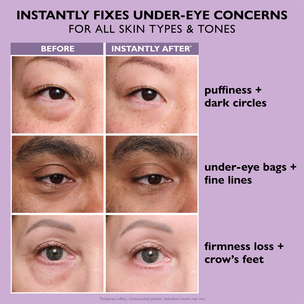 🚨 LIMITED TIME ✨ Instant Eye Bag Eraser 🧴 Blur Wrinkles, Lift & Firm in Seconds 💫